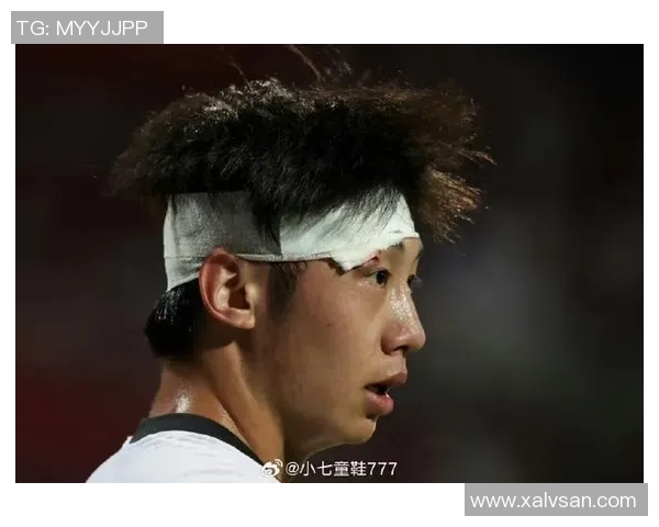 足球运动员手腕缠绷带的意义与影响解析及其对比赛表现的影响